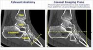 پاورپوینت تکنیک های تصویربرداری پزشکی (مچ، کف پا و ساق)